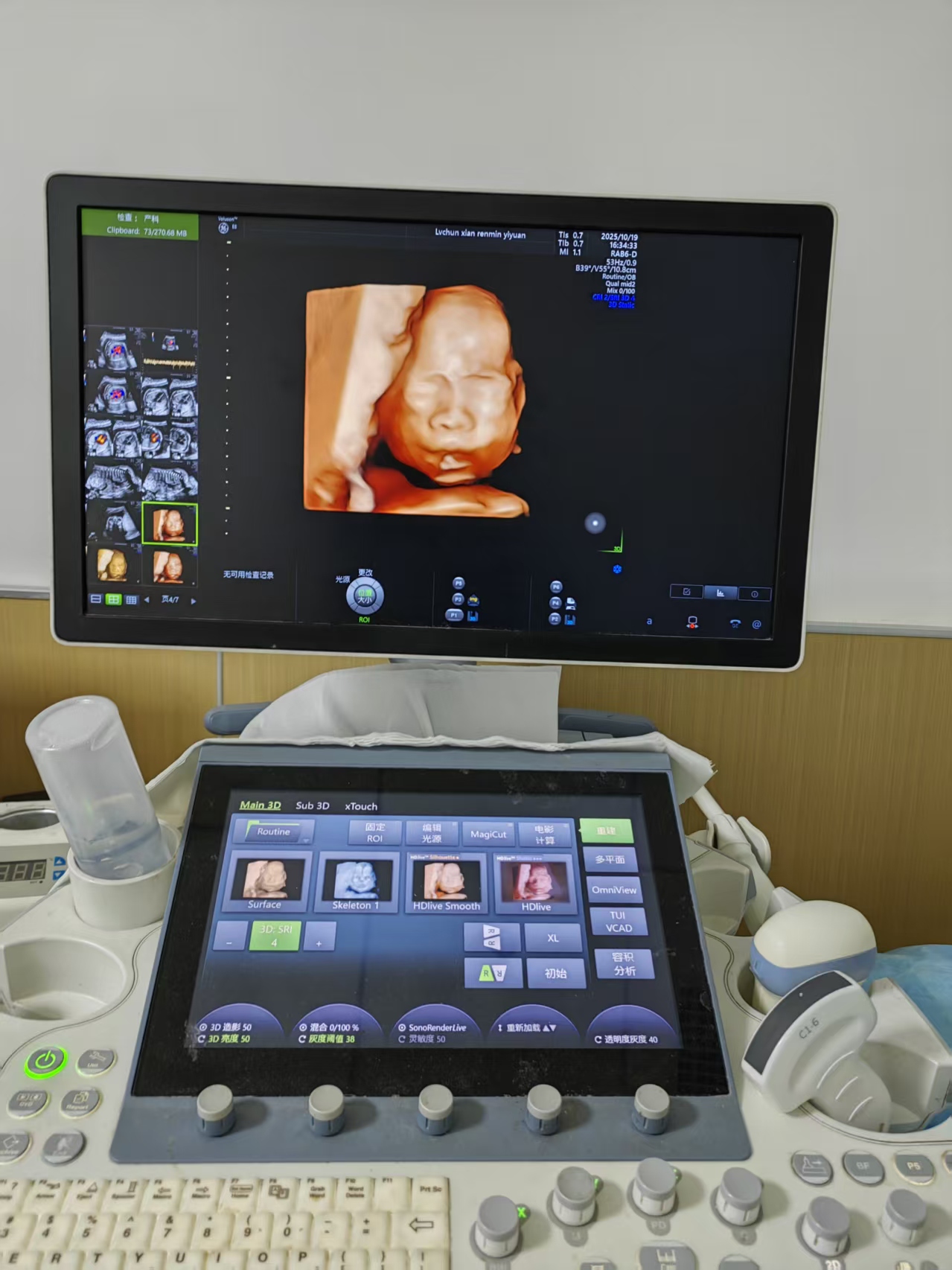 胎儿大畸形筛查中,三维与四维究竟有什么区